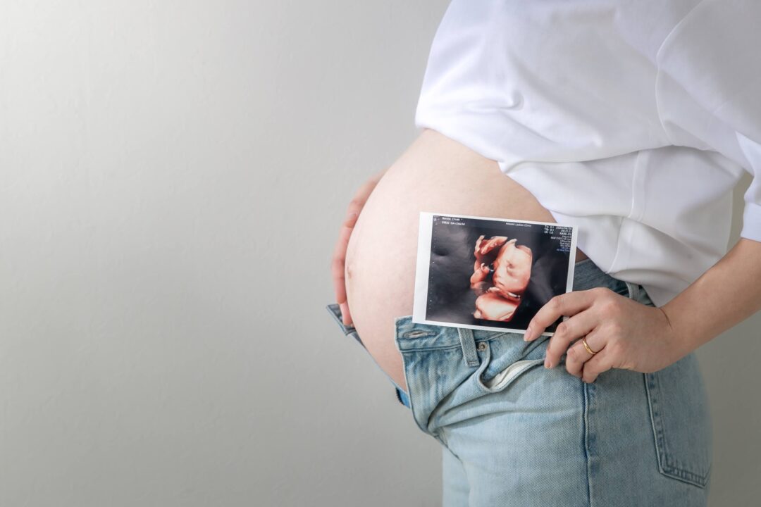 MATERNITY8